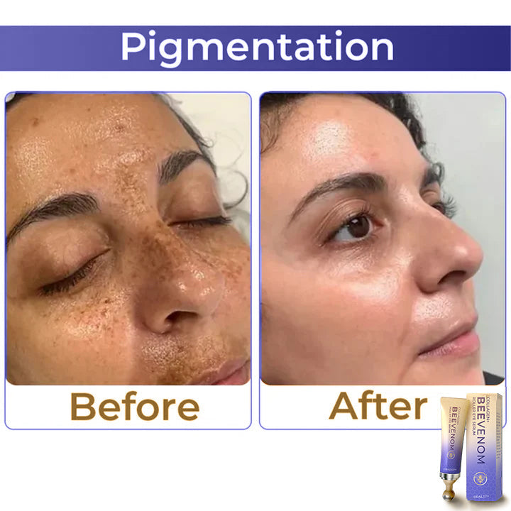 ✨ ODALIT™ Collagen+ Bee Venom Roller Eye Cream 🇦🇺 Dermatologist Approved