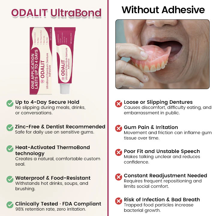 ODALIT UltraBond Premium Denture Adhesive 🔥(Clinically Proven 4-Day Hold for Secure, Comfortable & Zinc-Free Denture Fit 🦷)