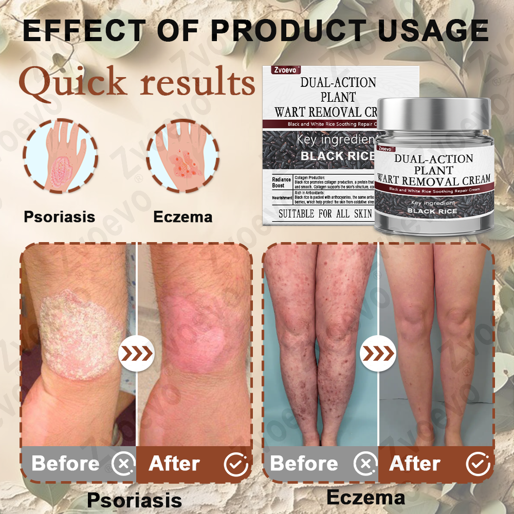 ✅ Zvoevo® Rice Bran Extract Cream 👩‍⚕️ TGA-Certified (For removing warts and skin growths, eliminating skin hyperplasia and keratin buildup, treating skin cancer, age spots, and hyperpigmentation)
