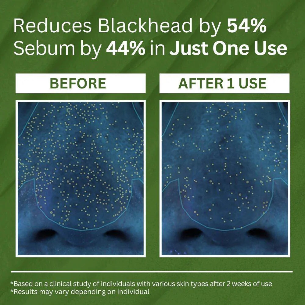 Complex Acid Avocado Cleansing Facial Bubble Mask