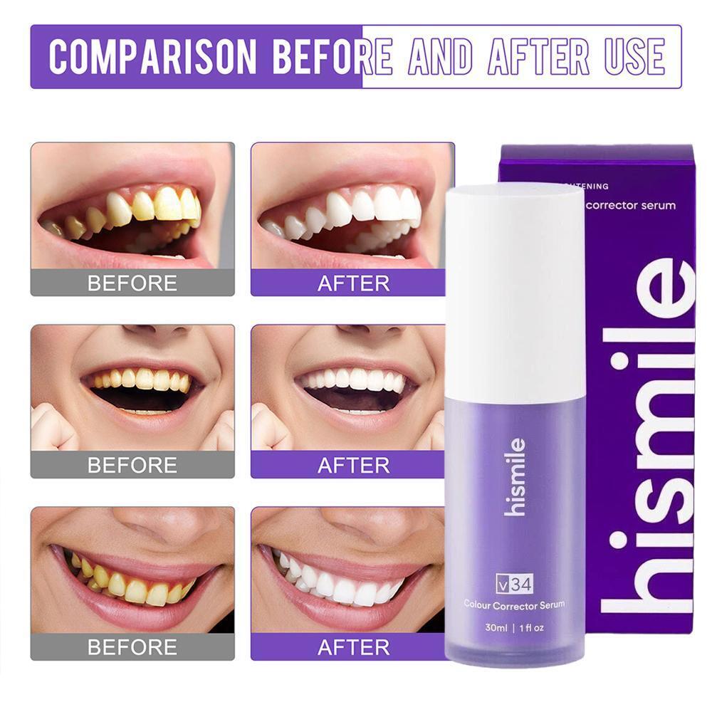 2 Pcs Teeth Whitening Serum (Guaranteed Result)
